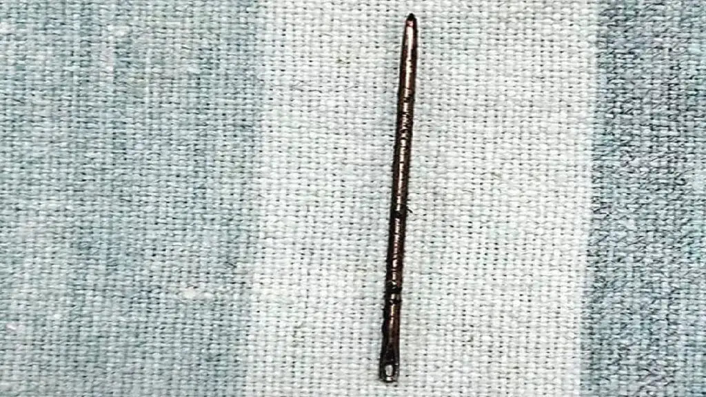 Man Suffers from Needle in Stomach for 3 Months, Undergoes Life-Saving Surgery in Hyderabad