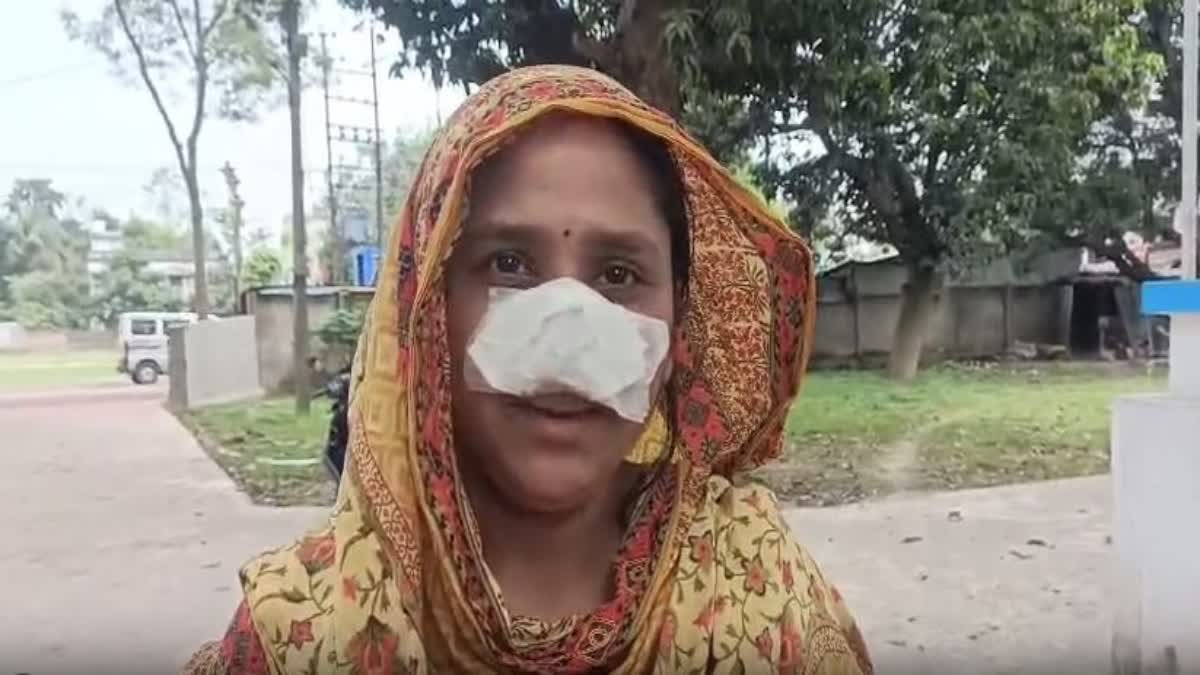 Husband Bites Wife’s Nose While She Sleeps in Shocking Incident in Nadia District